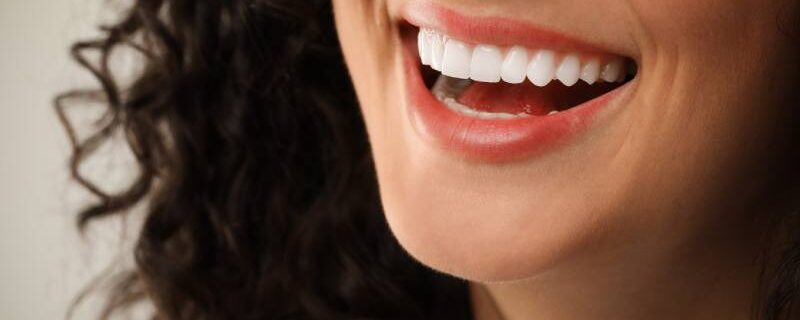 cosmetic dentist in san francisco dental veneers