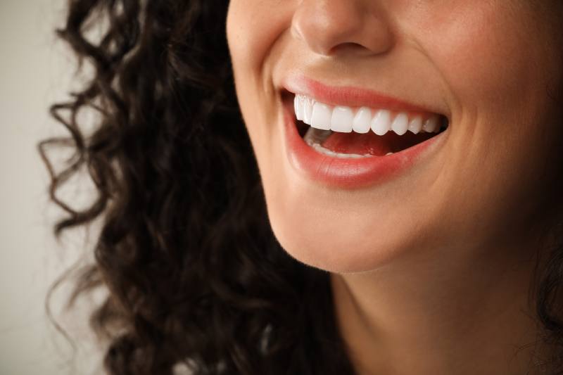 cosmetic dentist in san francisco dental veneers