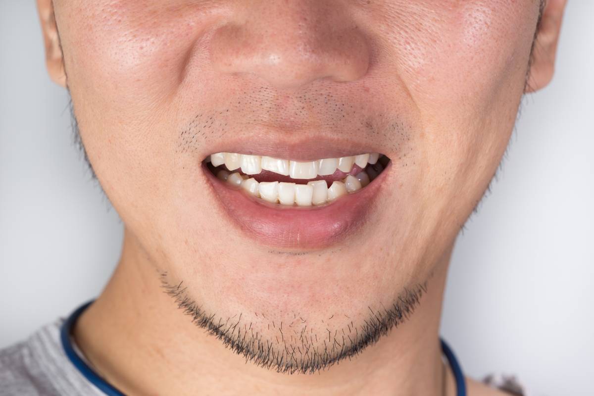 Cosmetic Dentistry in San Francisco | San Francisco Dental Associates
